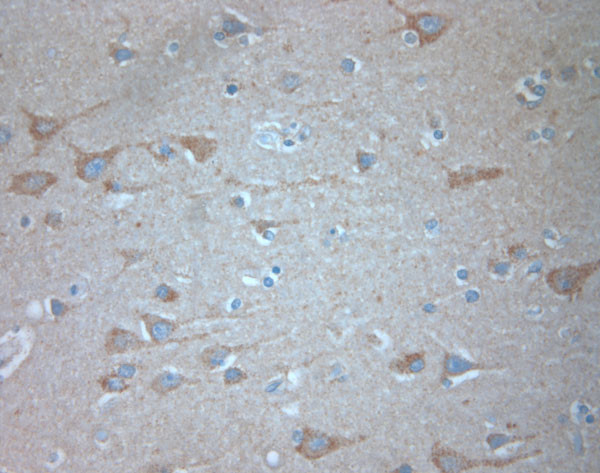 KCNA3 Antibody in Immunohistochemistry (Paraffin) (IHC (P))