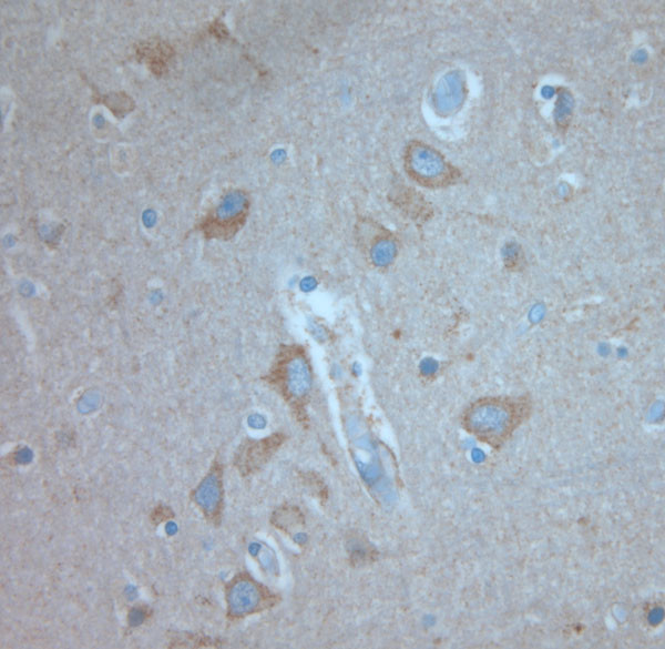 KCNA3 Antibody in Immunohistochemistry (Paraffin) (IHC (P))