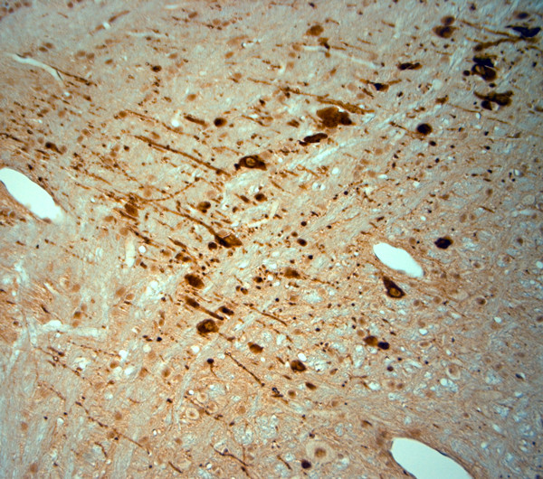 KCNJ10 Antibody in Immunohistochemistry (Paraffin) (IHC (P))