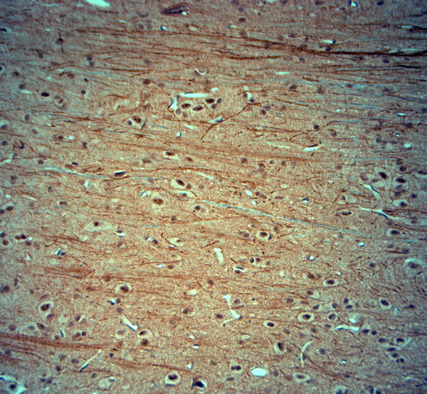 KCNJ10 Antibody in Immunohistochemistry (Paraffin) (IHC (P))