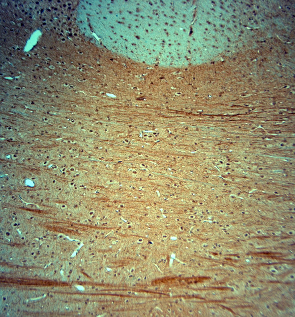 KCNJ10 Antibody in Immunohistochemistry (Paraffin) (IHC (P))