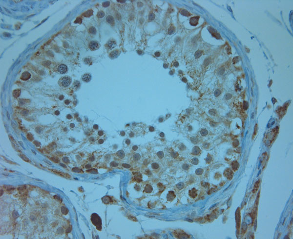 KCNJ13 Antibody in Immunohistochemistry (Paraffin) (IHC (P))