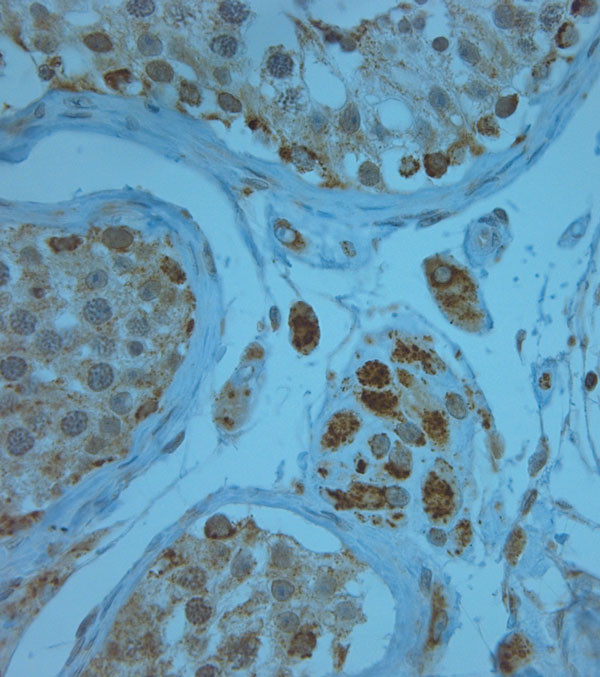 KCNJ13 Antibody in Immunohistochemistry (Paraffin) (IHC (P))