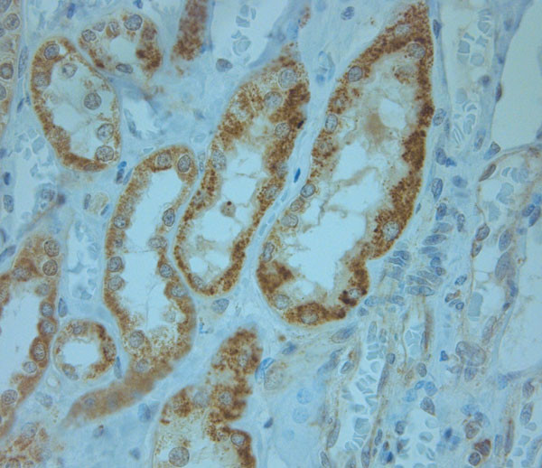 KCNJ13 Antibody in Immunohistochemistry (Paraffin) (IHC (P))