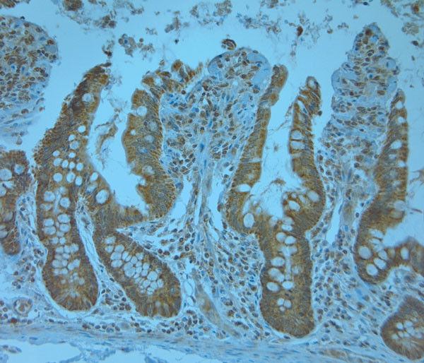 KCNJ13 Antibody in Immunohistochemistry (Paraffin) (IHC (P))