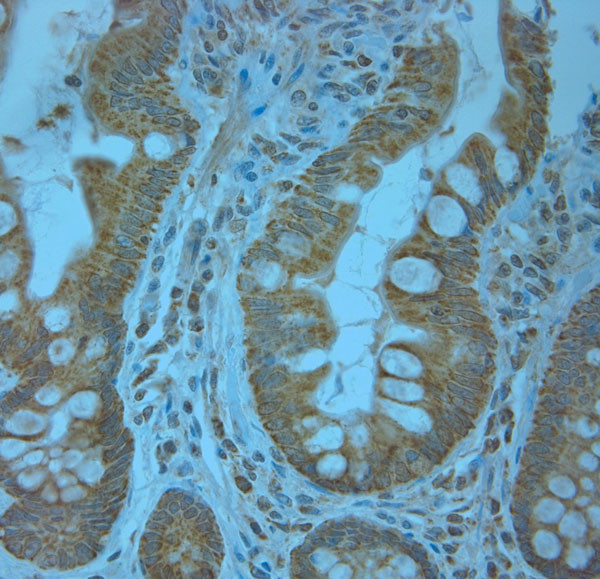 KCNJ13 Antibody in Immunohistochemistry (Paraffin) (IHC (P))