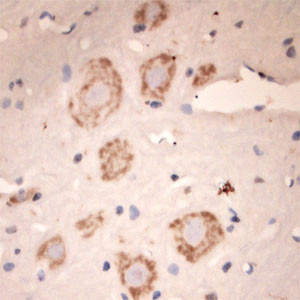 Lamp1 Antibody in Immunohistochemistry (Paraffin) (IHC (P))