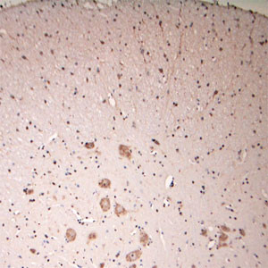 Lamp1 Antibody in Immunohistochemistry (Paraffin) (IHC (P))