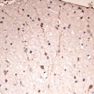 Lamp1 Antibody in Immunohistochemistry (Paraffin) (IHC (P))