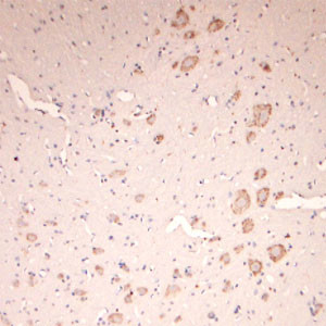 Lamp1 Antibody in Immunohistochemistry (Paraffin) (IHC (P))