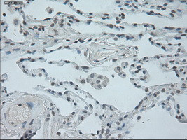 OSM Antibody in Immunohistochemistry (Paraffin) (IHC (P))