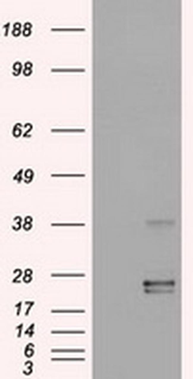 OSM Antibody in Western Blot (WB)