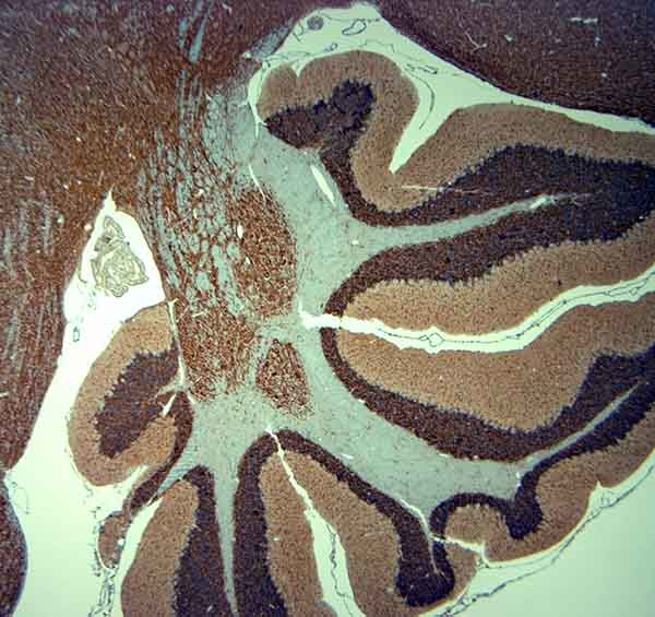 MAP2 Antibody in Immunohistochemistry (Paraffin) (IHC (P))