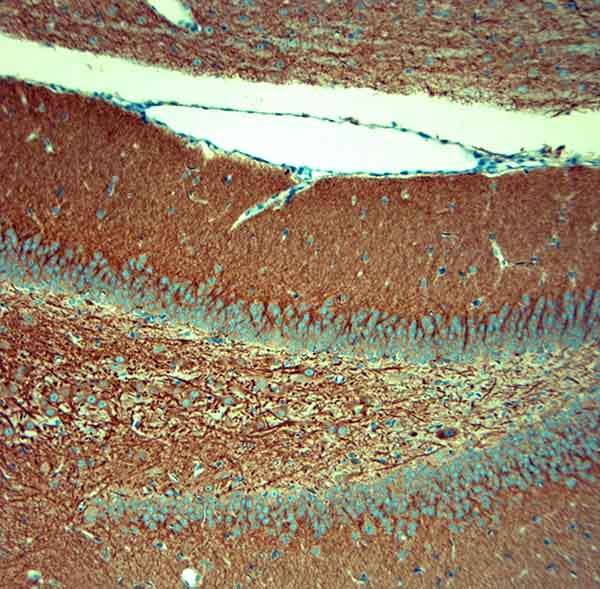 MAP2 Antibody in Immunohistochemistry (Paraffin) (IHC (P))