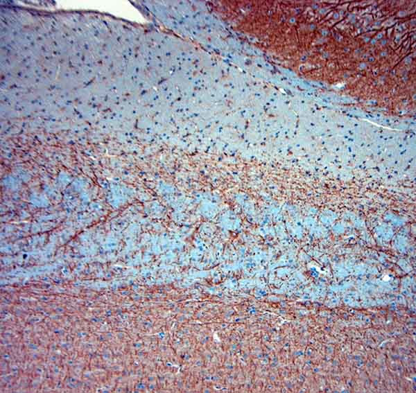 MAP2 Antibody in Immunohistochemistry (Paraffin) (IHC (P))