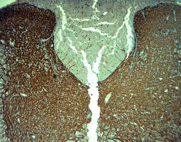 MAP2 Antibody in Immunohistochemistry (Paraffin) (IHC (P))