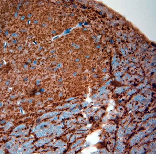 MAP2 Antibody in Immunohistochemistry (Paraffin) (IHC (P))