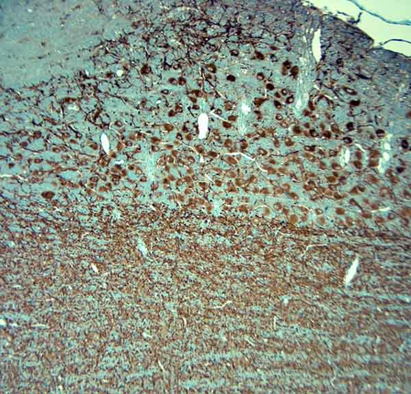 MAP2 Antibody in Immunohistochemistry (Paraffin) (IHC (P))