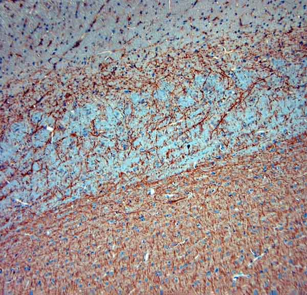 MAP2 Antibody in Immunohistochemistry (Paraffin) (IHC (P))