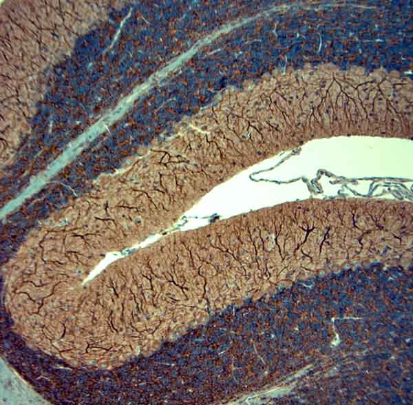 MAP2 Antibody in Immunohistochemistry (Paraffin) (IHC (P))