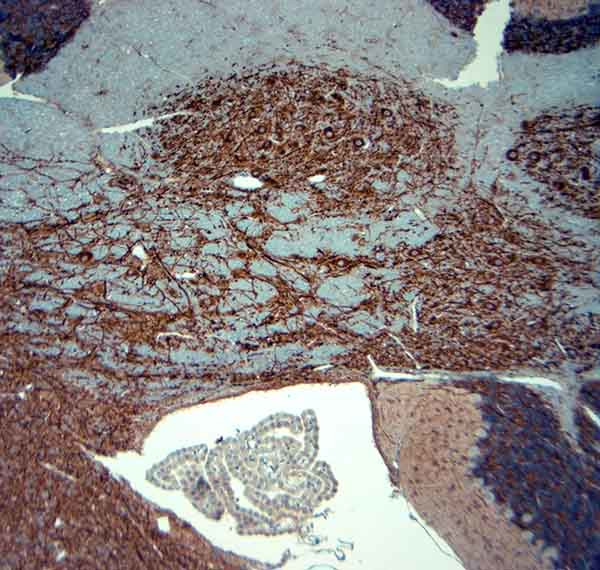 MAP2 Antibody in Immunohistochemistry (Paraffin) (IHC (P))