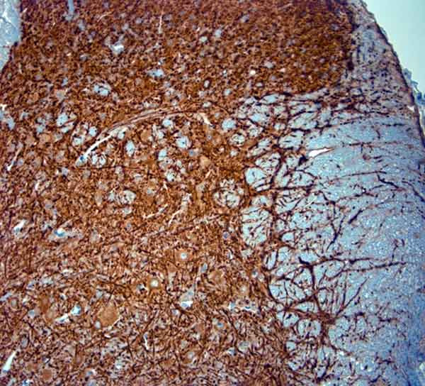 MAP2 Antibody in Immunohistochemistry (Paraffin) (IHC (P))