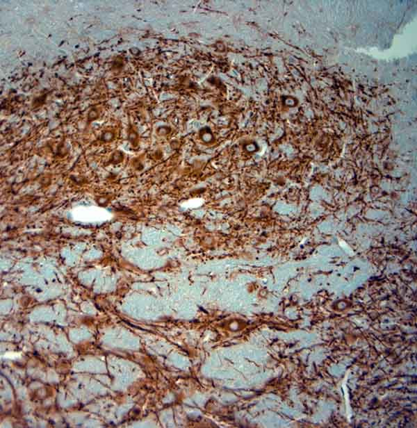 MAP2 Antibody in Immunohistochemistry (Paraffin) (IHC (P))