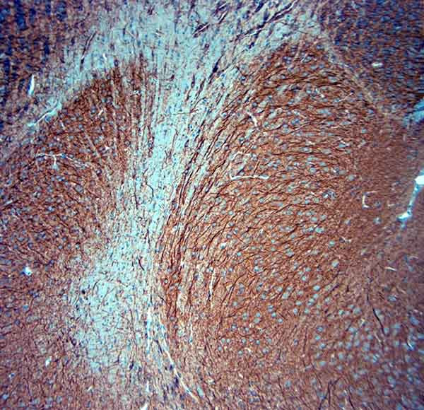 MAP2 Antibody in Immunohistochemistry (Paraffin) (IHC (P))