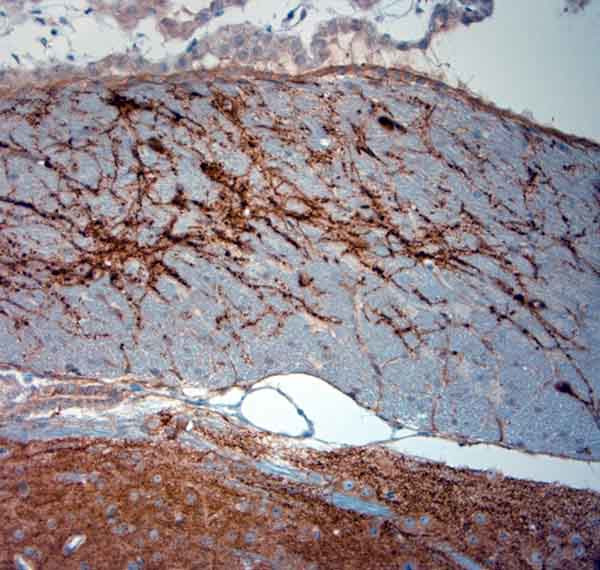 MAP2 Antibody in Immunohistochemistry (Paraffin) (IHC (P))