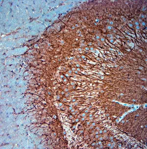 MAP2 Antibody in Immunohistochemistry (Paraffin) (IHC (P))