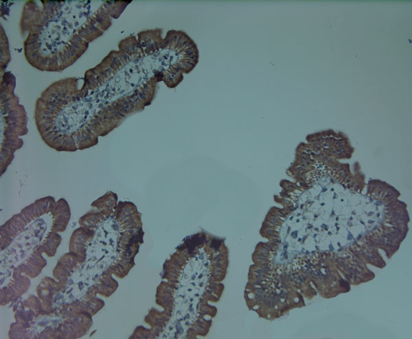 Mitofusin 1 Antibody in Immunohistochemistry (Paraffin) (IHC (P))