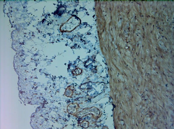 Mitofusin 1 Antibody in Immunohistochemistry (Paraffin) (IHC (P))