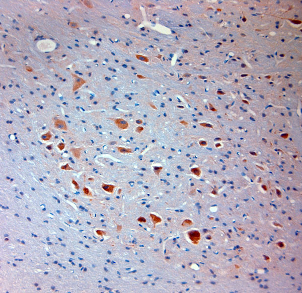 Mortalin Antibody in Immunohistochemistry (Paraffin) (IHC (P))