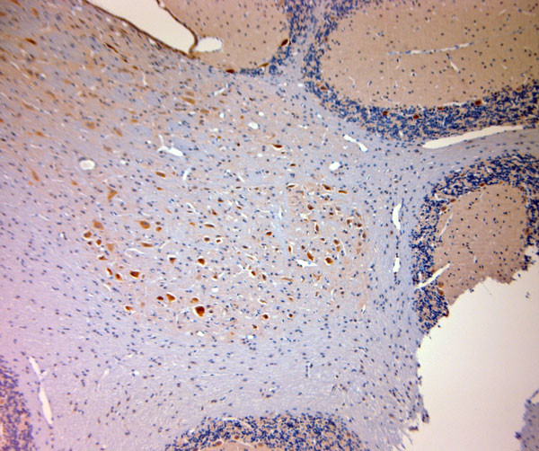 Mortalin Antibody in Immunohistochemistry (Paraffin) (IHC (P))