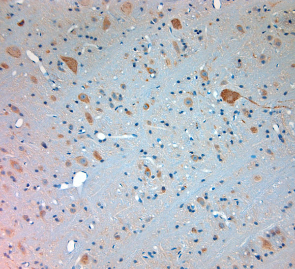 Mortalin Antibody in Immunohistochemistry (Paraffin) (IHC (P))