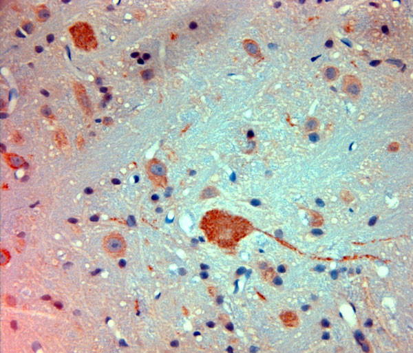 Mortalin Antibody in Immunohistochemistry (Paraffin) (IHC (P))