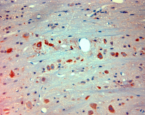 Mortalin Antibody in Immunohistochemistry (Paraffin) (IHC (P))