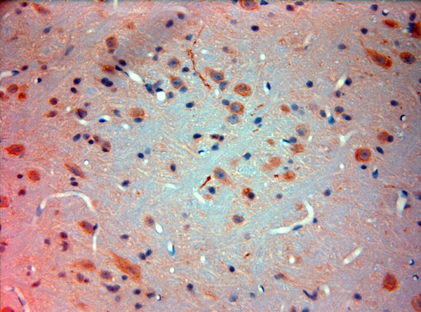 Mortalin Antibody in Immunohistochemistry (Paraffin) (IHC (P))