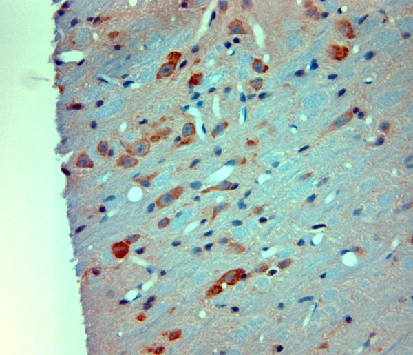 Mortalin Antibody in Immunohistochemistry (Paraffin) (IHC (P))