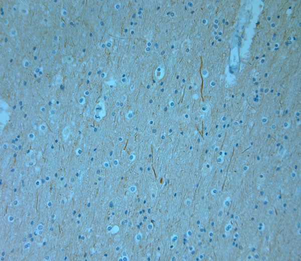 MPP1 Antibody in Immunohistochemistry (Paraffin) (IHC (P))