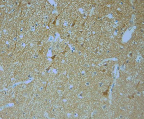 MPP1 Antibody in Immunohistochemistry (Paraffin) (IHC (P))