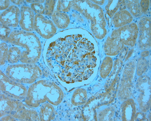 MPP1 Antibody in Immunohistochemistry (Paraffin) (IHC (P))