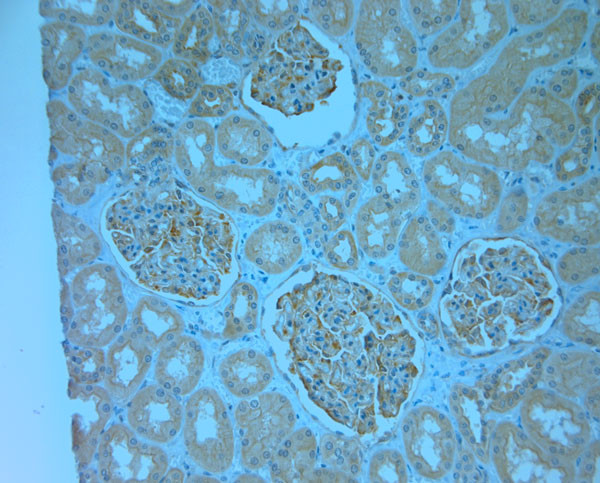 MPP1 Antibody in Immunohistochemistry (Paraffin) (IHC (P))