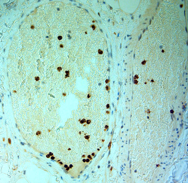 MPO Antibody in Immunohistochemistry (Paraffin) (IHC (P))