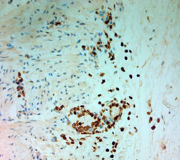 MPO Antibody in Immunohistochemistry (Paraffin) (IHC (P))