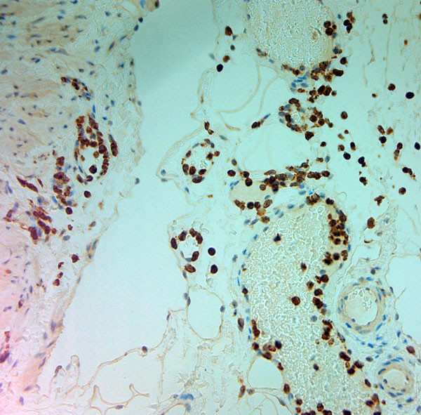 MPO Antibody in Immunohistochemistry (Paraffin) (IHC (P))