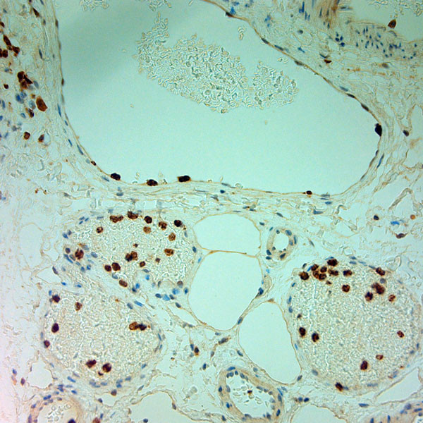 MPO Antibody in Immunohistochemistry (Paraffin) (IHC (P))