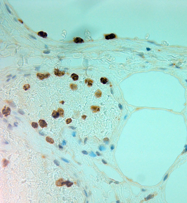 MPO Antibody in Immunohistochemistry (Paraffin) (IHC (P))