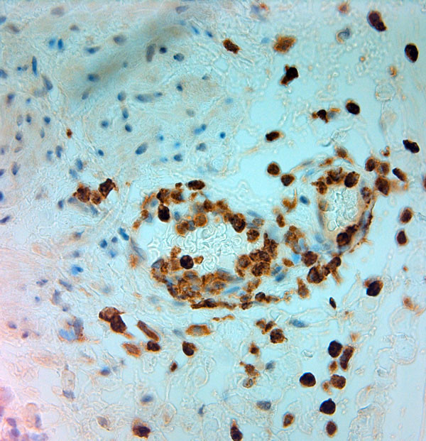 MPO Antibody in Immunohistochemistry (Paraffin) (IHC (P))