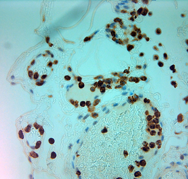 MPO Antibody in Immunohistochemistry (Paraffin) (IHC (P))